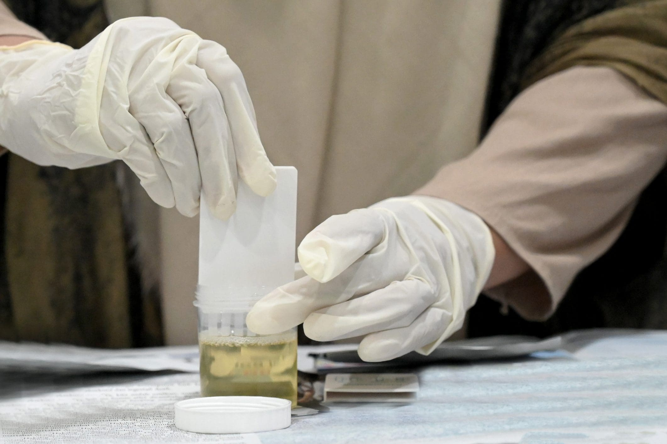 Lab worker preparing urine test kit.