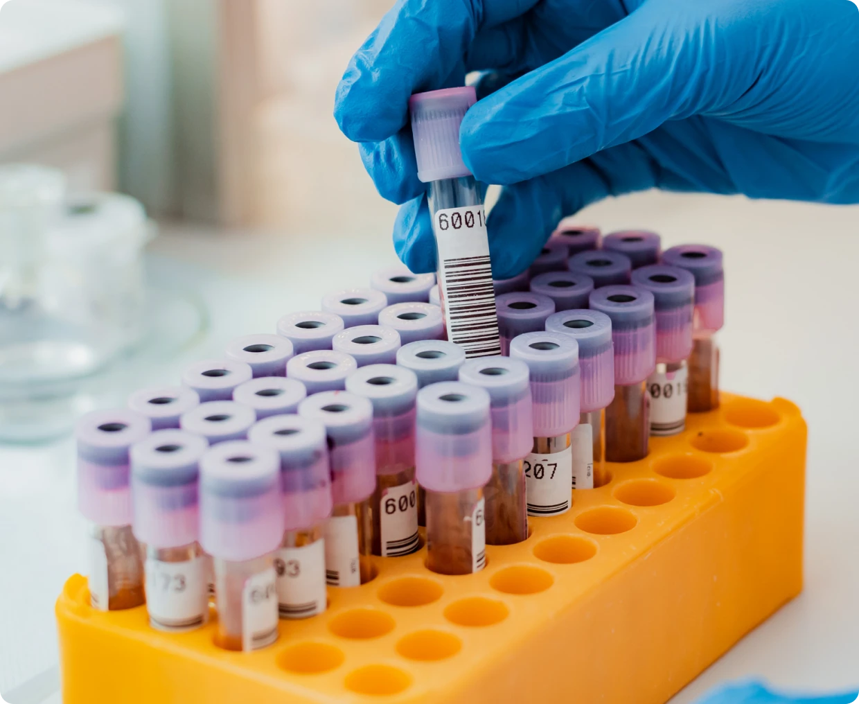 Gloved hand handling blood test tubes