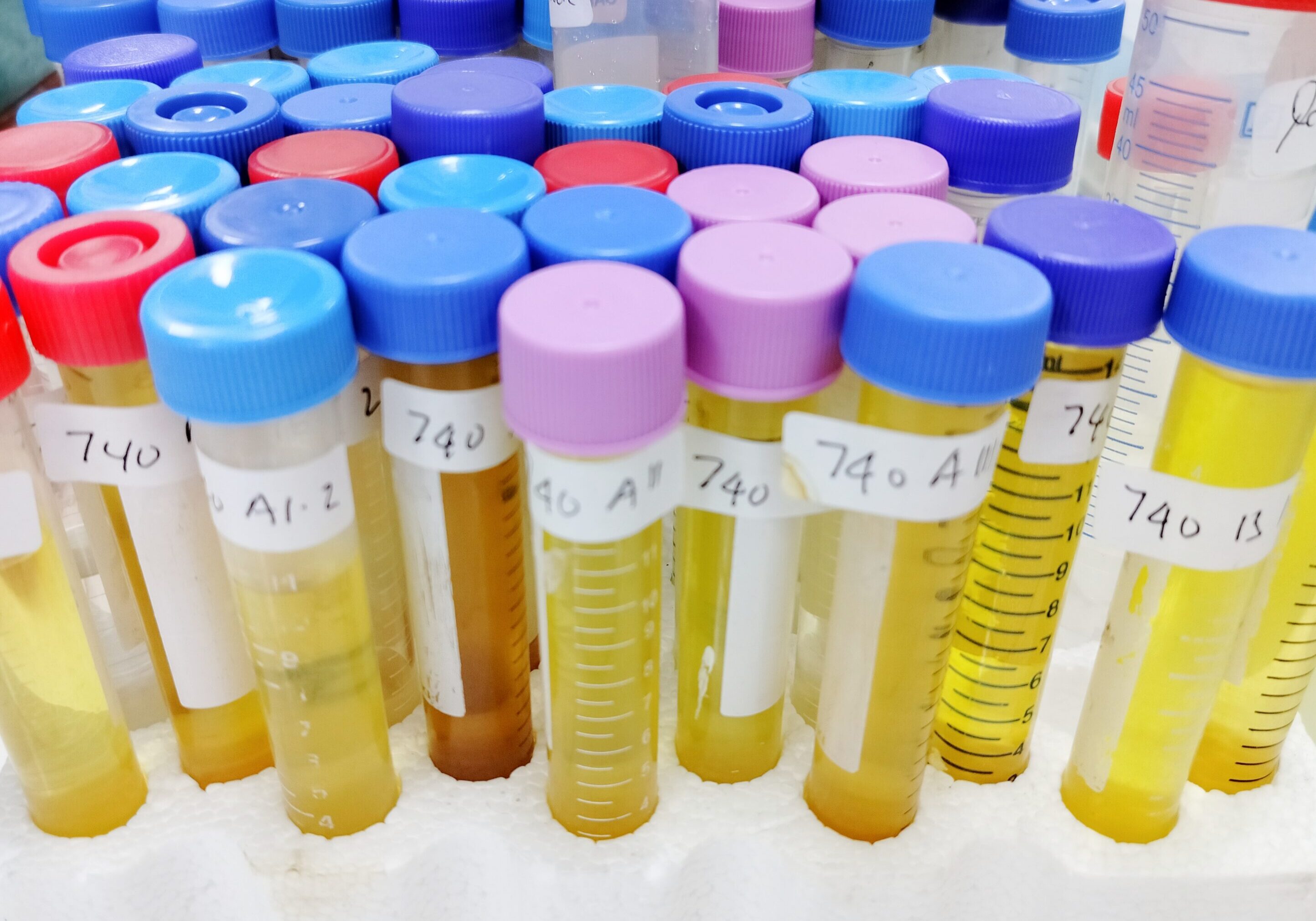 Test tubes with colorful caps in laboratory