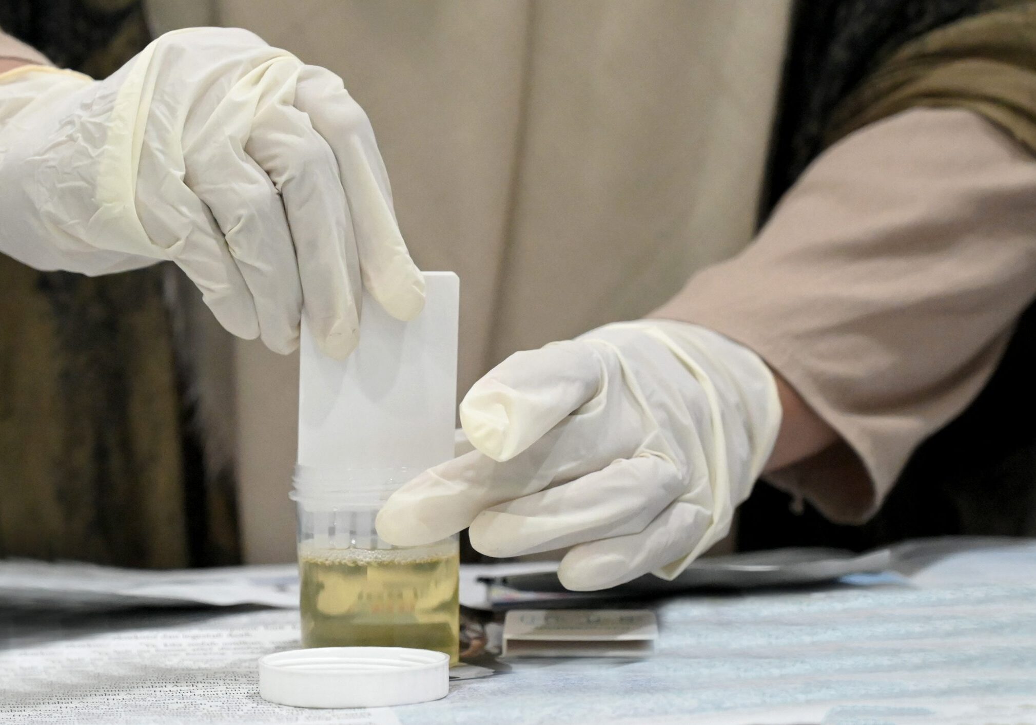 Lab worker preparing urine test kit.